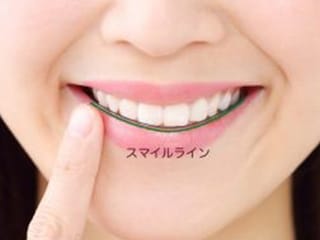 盛岡（盛岡市）の歯医者、医療法人啓仁会 栃内歯科医院の審美歯科治療