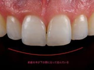 盛岡（盛岡市）の歯医者、医療法人啓仁会 栃内歯科医院の審美歯科治療