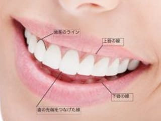 盛岡（盛岡市）の歯医者、医療法人啓仁会 栃内歯科医院の審美歯科治療